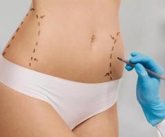 Peonia Medical | Expert Liposuction Services