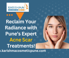 Acne Scar Removal Treatment In Pune | Karishma Cosmetic