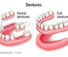 Dentures in Azle, TX