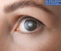 Cataract Treatment in India