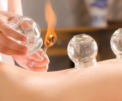 Fire Cupping in Bedford: Rejuvenate Your Body at Coastal Sports And Wellness