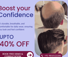 Non-Surgical Hair Replacement & Baldness Solutions in Delhi