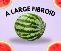 How UFE Fibroids Procedure Works on All Sizes