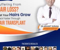 Hair Transplant Clinic in Delhi