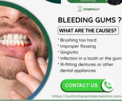 Best dental clinic kompally