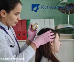 Best Doctor for Hair Fall Treatment in Santacruz West | Kosmoderma Skin Clinic