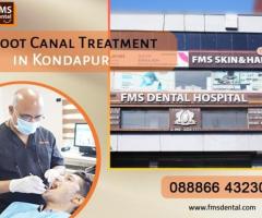 RCT Specilaist in Kondapur| Hyderabad