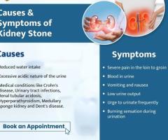 Best Kidney Stone Treatment in Jaipur at Vyas Hopital