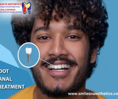 Root Canal Treatment in Koramangala: Smiles N Aesthetics - 1