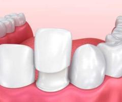 Best Dental Clinic in Coimbatore With Top Dental Treatments