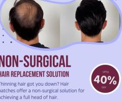 Non-Surgical Hair Replacement & Baldness Solutions in Delhi