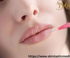 Enhance Your Smile with Lip Fillers Riverside at Skintastic