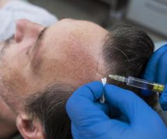 Understanding Hair Transplant with Dr. Amit Gupta: Your Trusted Cosmetic/Plastic Surgeon