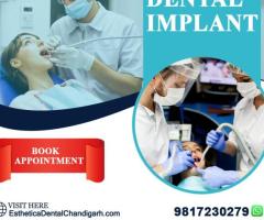 Best Dental Implant Near Mohali - Esthetica Dental Chandigarh