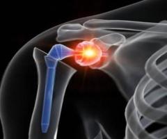 Best Orthopedic Doctor in Bangalore Near Me - Knee Replacements Doctors In Bangalore