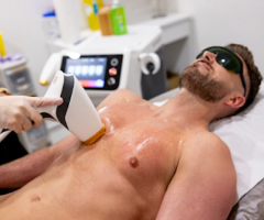 Laser Hair Removal in Lucknow