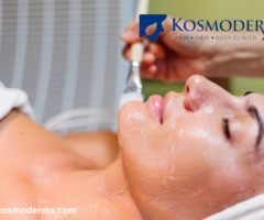 Chemical Peel for Open Pores & Acne Scars in Delhi – Effective Skin Treatment at Kosmoderma