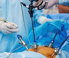 Best Laparoscopic Surgeon in Indore - Dr. Renu Sharma