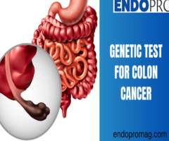 Exploring the Accuracy of Genetic Tests for Colon Cancer Risk