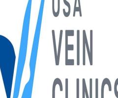 Advanced Vein Treatments at USA Vein Clinics in Woodbury, MN