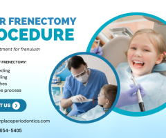 What is a Frenectomy Treatment ? Can Frenectomy Improve Your Smile ?