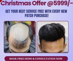 Premier Hair Replacement Solutions in Delhi: Transform Your Appearance Right Now