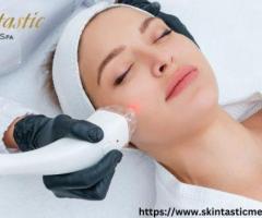 Effective Laser Hair Removal in Riverside by Skintastic