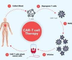 علاج الخلايا التائية CAR-T يُحدث ثورة في علاج السرطان، كرواتيا، مقاطعة كرابينا-زاجوريه