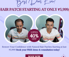 Premier Hair Replacement Solutions in Delhi: Transform Your Appearance Right Now