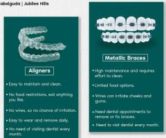 Leading Invisalign Treatment Provider | Roots Dental Care