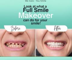 Full Smile Makeover by Trusted Dental Services Provider in Hyderabad