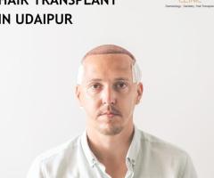 Top Reasons to Get a Hair Transplant in Udaipur