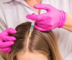 What Are the Benefits of PRP Treatment for Hair Loss?