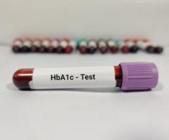 hba1c test price