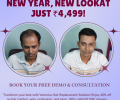 Non-Surgical Hair Replacement & Baldness Solutions in Delhi