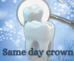 Same-Day Crowns  in Las Vegas at Functional Aesthetic Dentistry