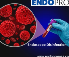 Advanced Endoscope Disinfection with Endopromagin – Reliable & Efficient