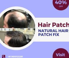 Non-Surgical Hair Replacement & Baldness Solutions in Delhi