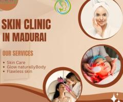 Top Skin Clinic in Madurai – Renew Hair and Skin Care