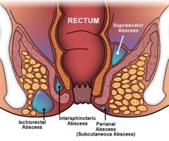 Best piles clinic in delhi