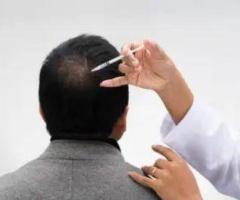 Advanced Hair Regrowth / Hair Loss Treatment in Coimbatore