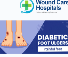 Best Diabetic Foot Ulcer Treatment in Hyderabad | Kukatpally | KPHB - WCH