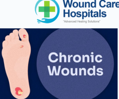 Chronic Wounds Treatment in hyderabad | Kukatpally | KPHB - WCH