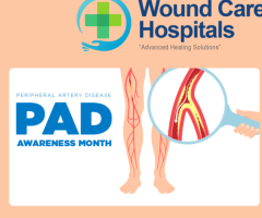 Peripheral Arterial Disease Treatment in Hyderabad | kukatpally - WCH