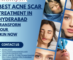 Best Acne Scar Treatment in Hyderabad – Transform Your Skin Now