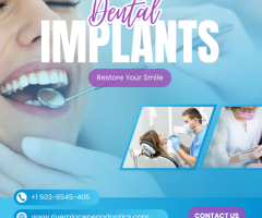 Are dental implants safe ? Benefits of dental implants !