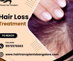 Best Hair Loss Treatment in Bangalore by Pioneer