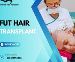 FUT Hair Transplant Cost in Bangalore-Pioneer Hair Transplant