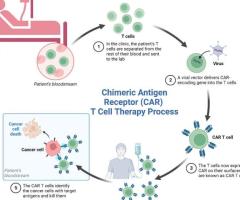 Exploring the Role of CAR T-Cell Therapy in Treating Blood Cancers, Sweden