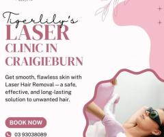 Laser clinic Craigieburn